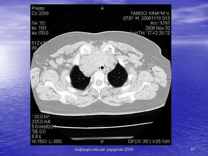 Кафедра общей хирургии 2006 97 