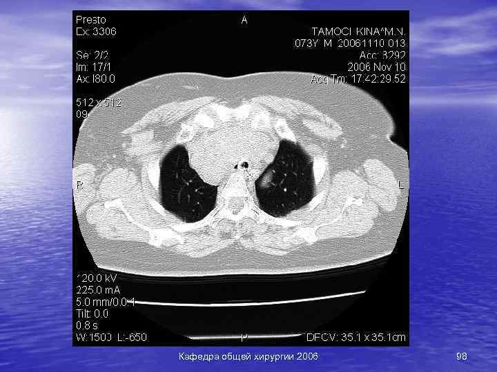 Кафедра общей хирургии 2006 98 