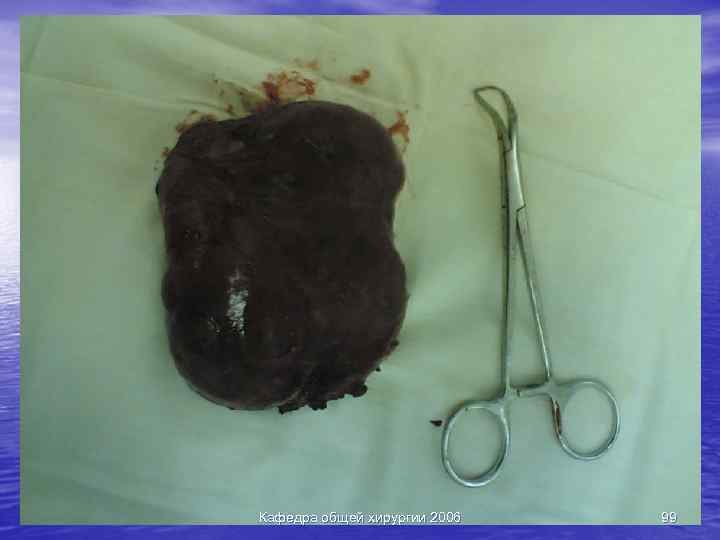 Кафедра общей хирургии 2006 99 