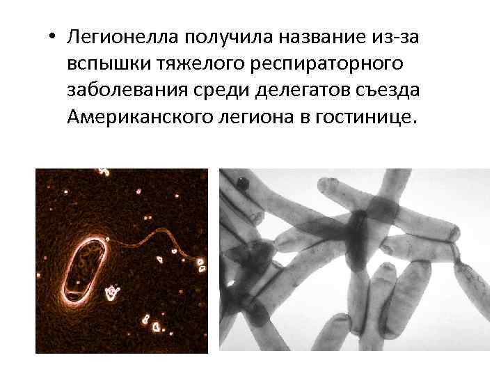  • Легионелла получила название из-за вспышки тяжелого респираторного заболевания среди делегатов съезда Американского