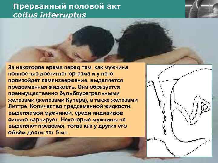 Прерванный половой акт coitus interruptus LOGO За некоторое время перед тем, как мужчина полностью