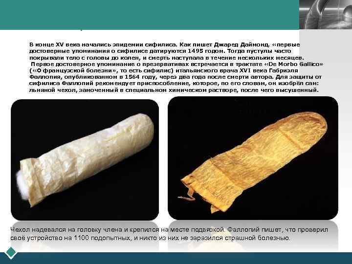  Эпоха Возрождения LOGO В конце XV века начались эпидемии сифилиса. Как пишет Джаред