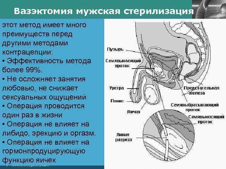 Вазэктомия мужская стерилизация этот метод имеет много преимуществ перед другими методами контрацепции: • Эффективность