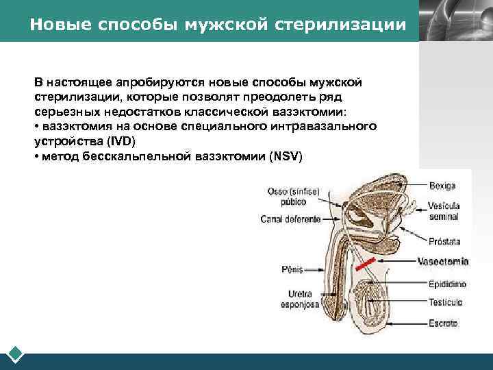 Новые способы мужской стерилизации В настоящее апробируются новые способы мужской стерилизации, которые позволят преодолеть