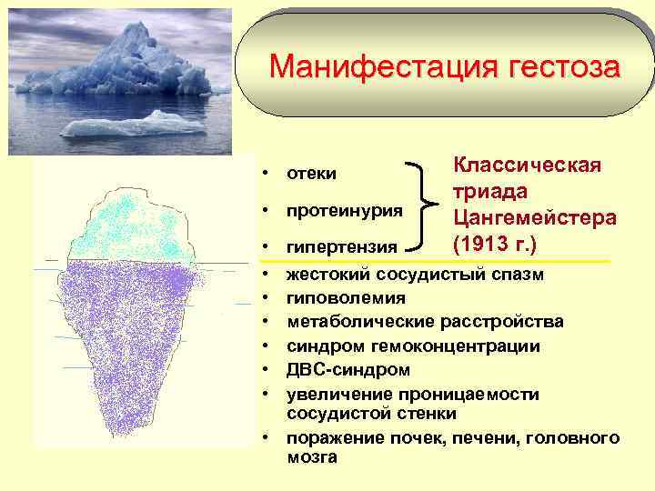 Манифестация гестоза • отеки • протеинурия • • Классическая триада Цангемейстера (1913 г. )