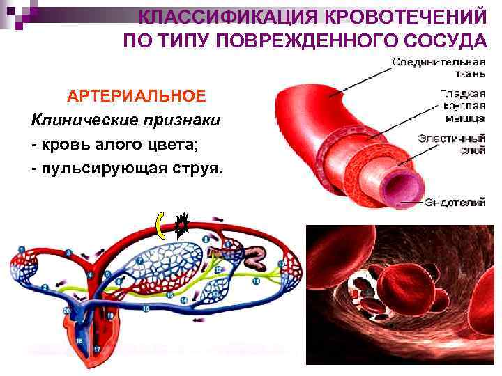 Какие признаки классификации кровотечений существуют закончите схему