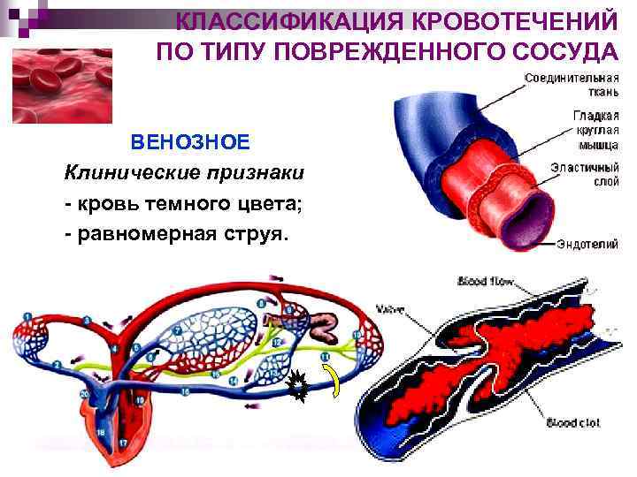 Какой сосуд поврежден на рисунке 2