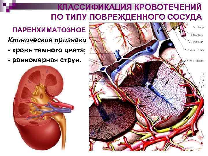 Рено паренхиматозный характер гематурии диагностика