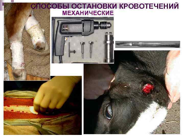 СПОСОБЫ ОСТАНОВКИ КРОВОТЕЧЕНИЙ МЕХАНИЧЕСКИЕ 