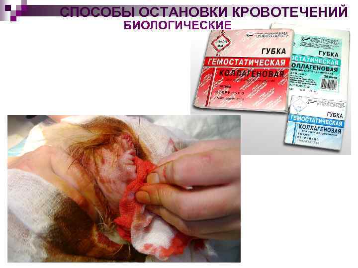 СПОСОБЫ ОСТАНОВКИ КРОВОТЕЧЕНИЙ БИОЛОГИЧЕСКИЕ 