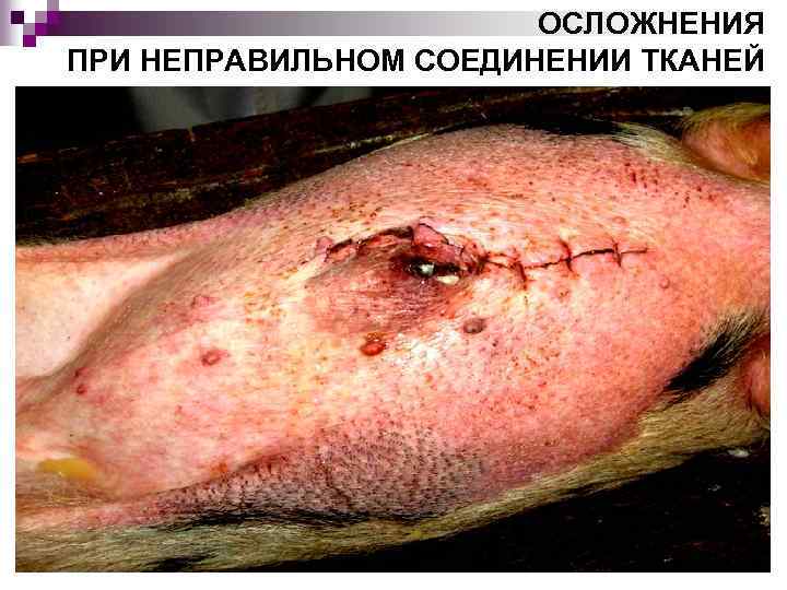 ОСЛОЖНЕНИЯ ПРИ НЕПРАВИЛЬНОМ СОЕДИНЕНИИ ТКАНЕЙ 