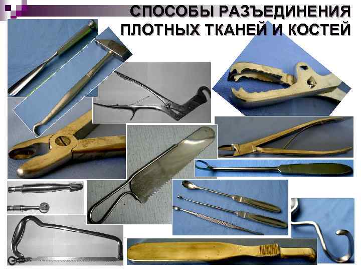 СПОСОБЫ РАЗЪЕДИНЕНИЯ ПЛОТНЫХ ТКАНЕЙ И КОСТЕЙ 