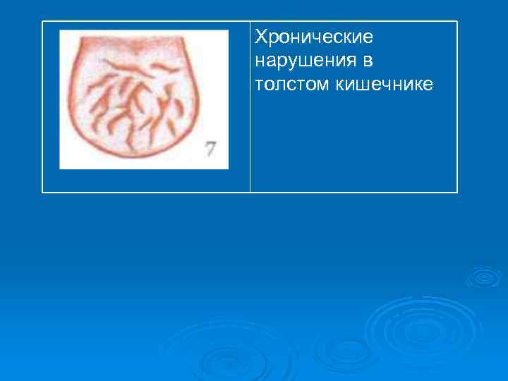 Хронические нарушения в толстом кишечнике 