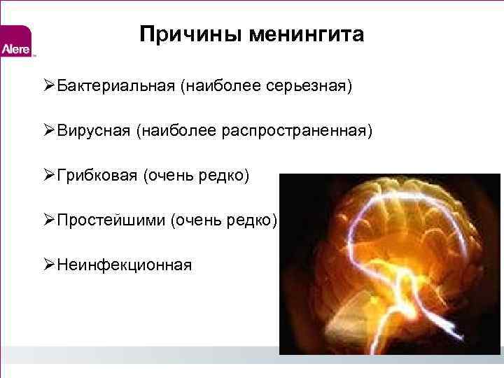 Причины менингита Бактериальная (наиболее серьезная) Вирусная (наиболее распространенная) Грибковая (очень редко) Простейшими (очень редко)