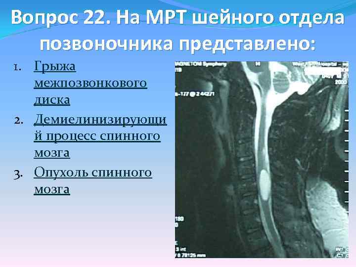 Мрт шейного отдела