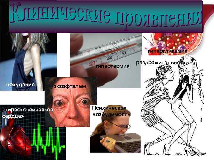 гипергликемия гипертермия похудение «тиреотоксическое сердце» экзофтальм Психическая возбудимость раздражительность 