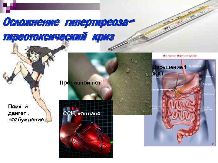 Осложнение гипертиреозатиреотоксический криз Нарушение f ЖКТ Проливной пот Псих. и двигат. возбуждение ССН, коллапс