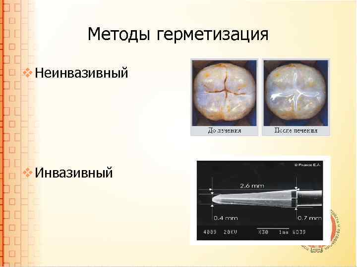 Методы герметизация v Неинвазивный v Инвазивный 