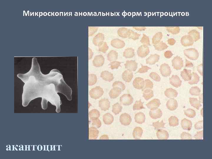 Аномальная картина 1 степени