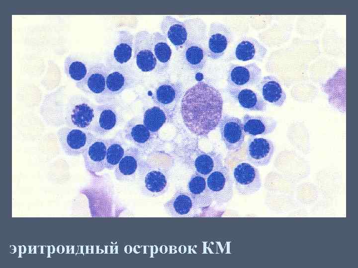 эритроидный островок КМ 