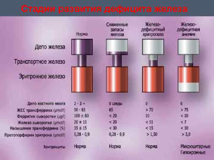 Стадии развития дефицита железа 