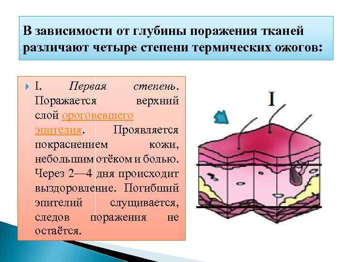 В зависимости от глубины поражения тканей различают четыре степени термических ожогов: I. Первая степень.