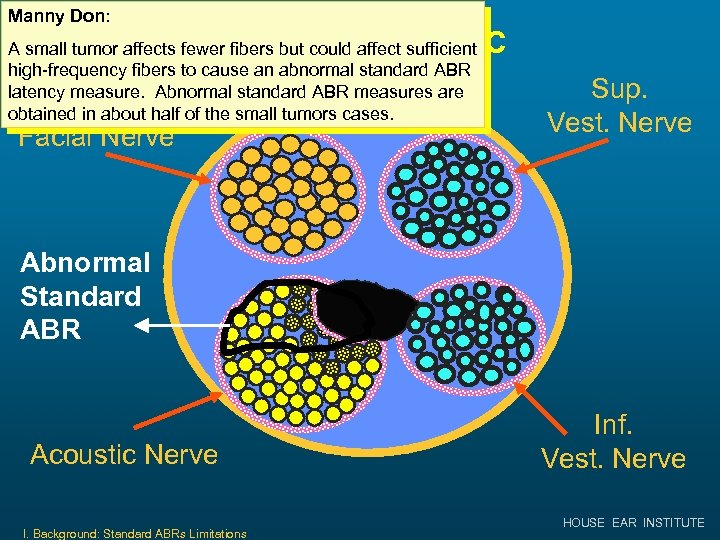 Manny Don: Small Tumor in IAC A small tumor affects fewer fibers but could