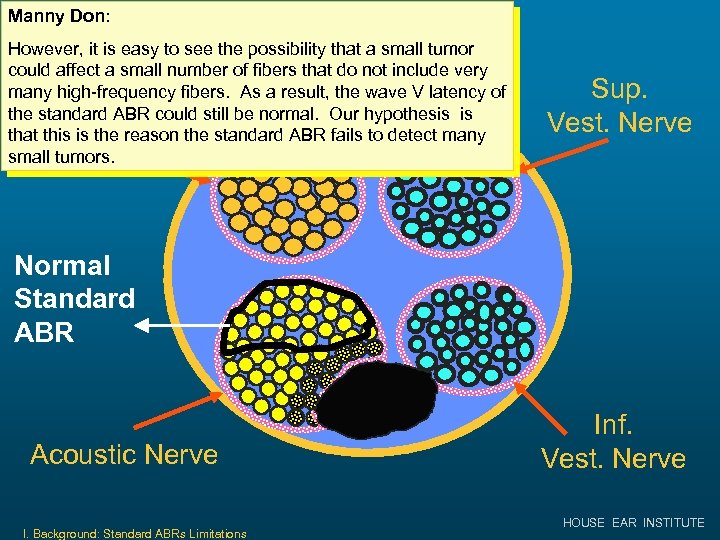 Manny Don: Small Tumor in IAC However, it is easy to see the possibility