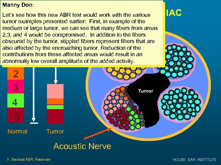 Manny Don: Medium or Large Tumor in IAC Let’s see how this new ABR
