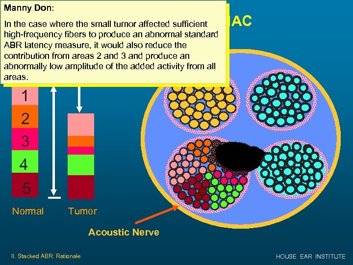 Manny Don: Small Tumor in IAC In the case where the small tumor affected