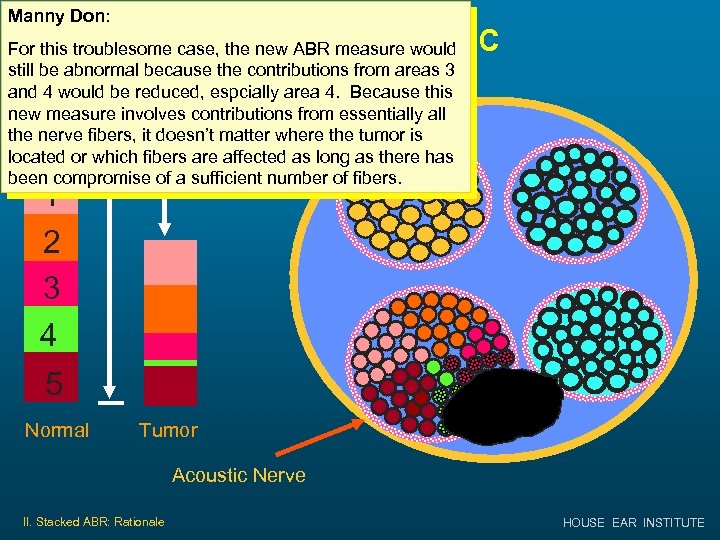 Manny Don: Small Tumor in IAC For this troublesome case, the new ABR measure