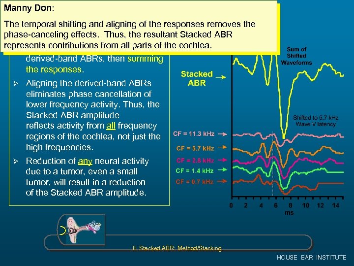 Manny Don: The Stacked ABR Technique The temporal shifting and aligning of the responses