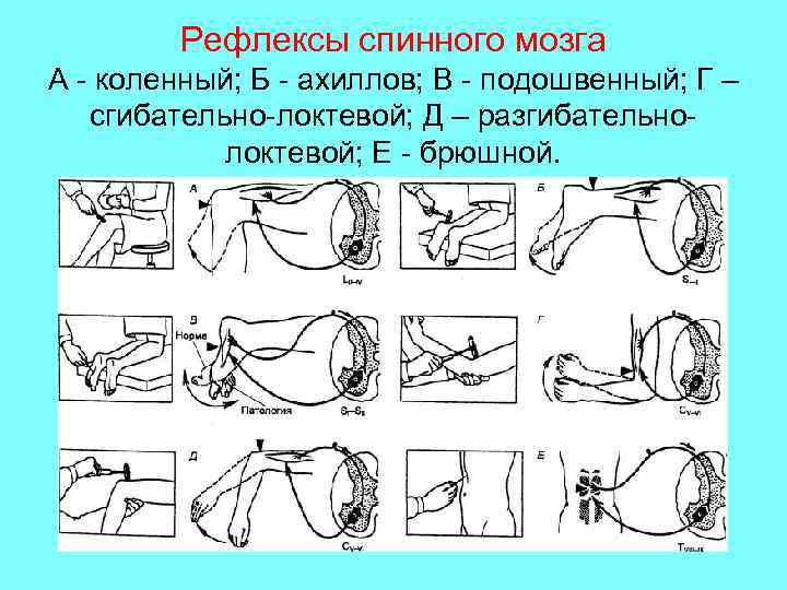 Схема рефлексов спинного мозга