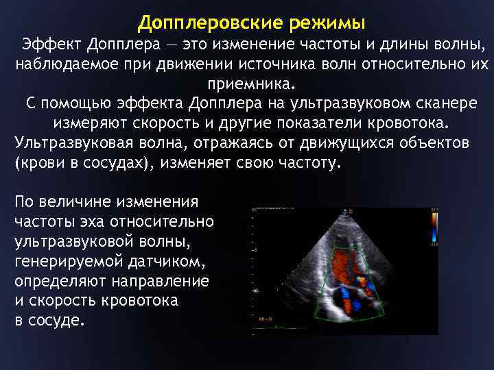 Допплеровские режимы Эффект Допплера — это изменение частоты и длины волны, наблюдаемое при движении