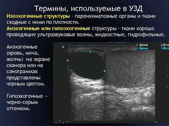 Термины, используемые в УЗД Изоэхогенные структуры – паренхиматозные органы и ткани сходные с ними