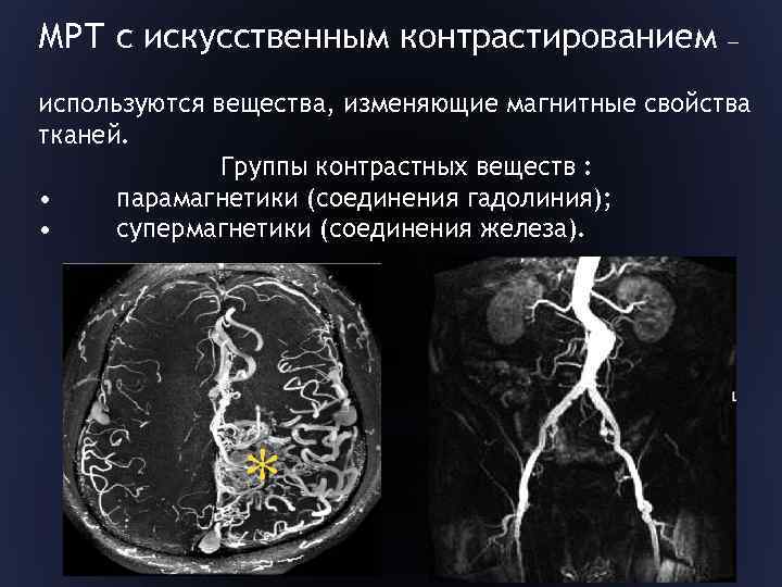 МРТ с искусственным контрастированием – используются вещества, изменяющие магнитные свойства тканей. Группы контрастных веществ