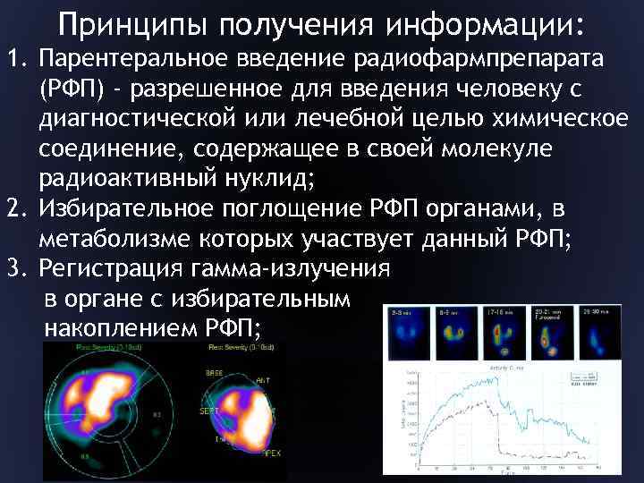Принципы получения информации: 1. Парентеральное введение радиофармпрепарата (РФП) - разрешенное для введения человеку с