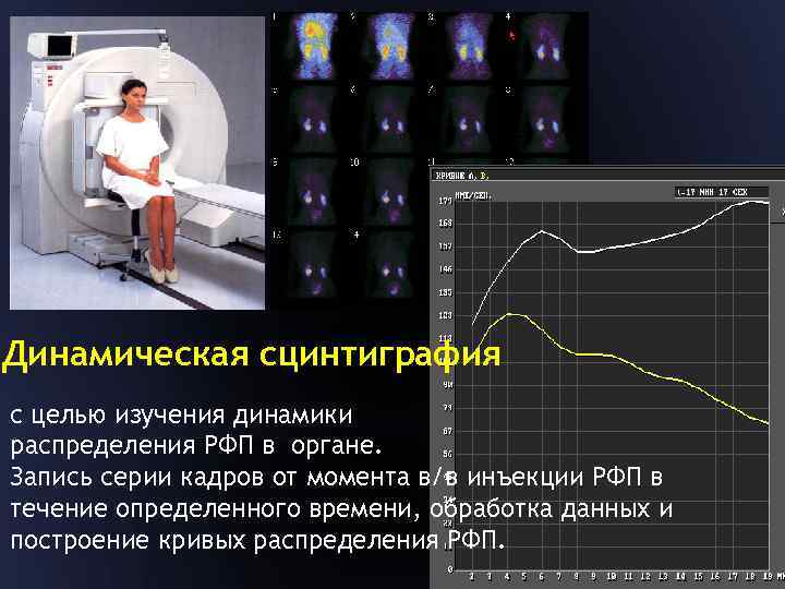 Узи лекции для врачей. Динамическая радионуклидная сцинтиграфия. Радионуклидная визуализация. Цель сцинтиграфии.