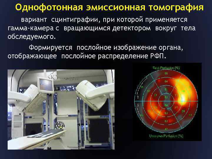 Что такое однофотонная эмиссионная компьютерная томография