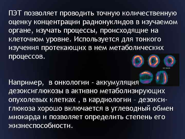 ПЭТ позволяет проводить точную количественную оценку концентрации радионуклидов в изучаемом органе, изучать процессы, происходящие