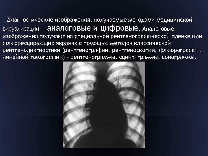 Диагностические изображения, получаемые методами медицинской визуализации — аналоговые и цифровые. Аналоговые изображения получают на