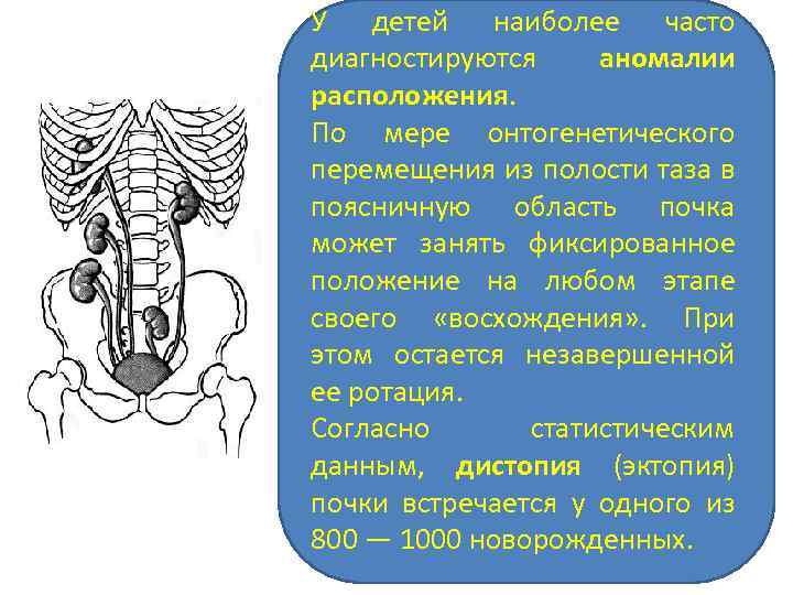 У детей наиболее часто диагностируются аномалии расположения. По мере онтогенетического перемещения из полости таза