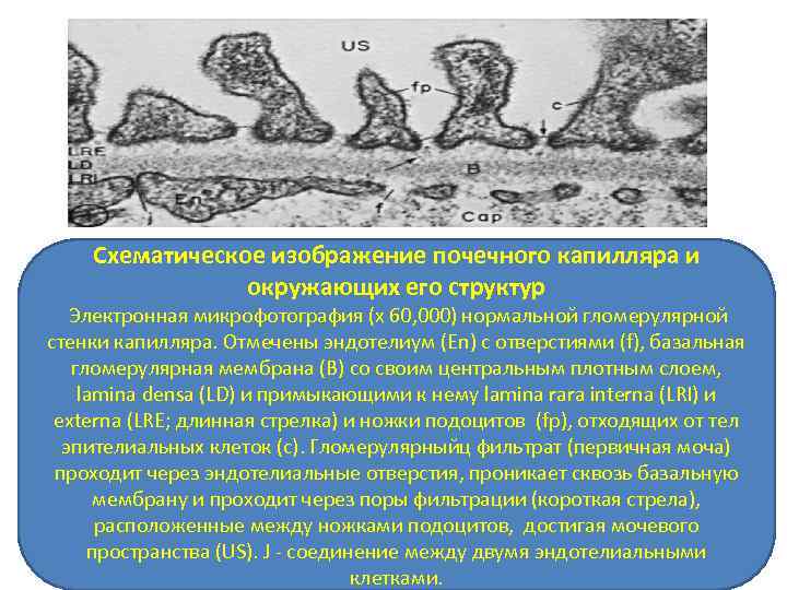 Схематическое изображение почечного капилляра и окружающих его структур Электронная микрофотография (x 60, 000) нормальной