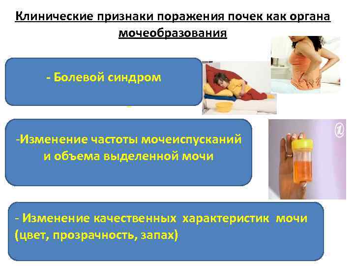 Клинические признаки поражения почек как органа мочеобразования - Болевой синдром -Изменение частоты мочеиспусканий и