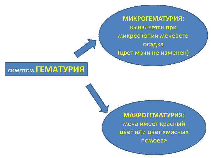 МИКРОГЕМАТУРИЯ: выявляется при микроскопии мочевого осадка (цвет мочи не изменен) симптом ГЕМАТУРИЯ МАКРОГЕМАТУРИЯ: моча