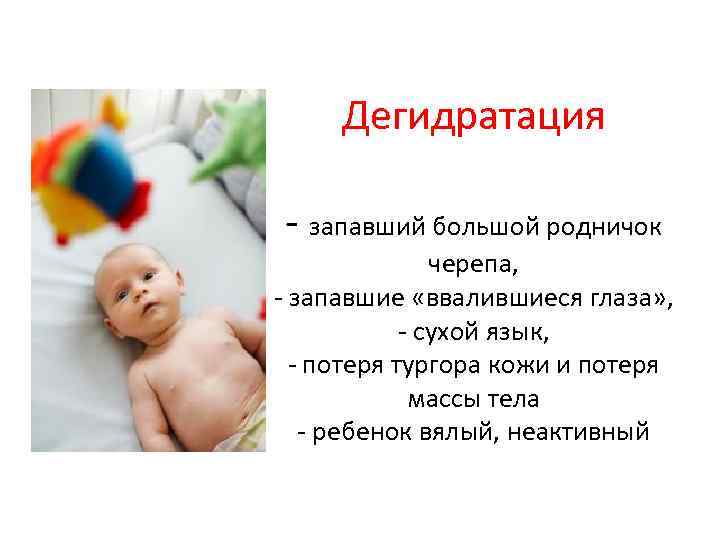 Дегидратация запавший большой родничок черепа, запавшие «ввалившиеся глаза» , сухой язык, потеря тургора кожи