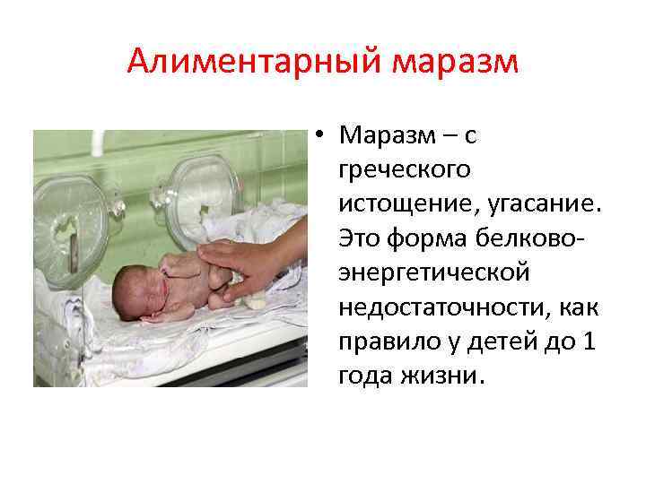 Алиментарный маразм • Маразм – с греческого истощение, угасание. Это форма белково энергетической недостаточности,