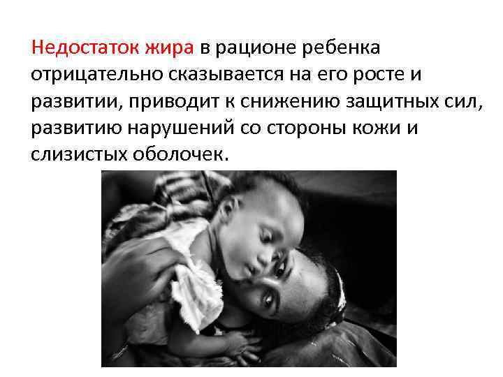 Недостаток жира в рационе ребенка отрицательно сказывается на его росте и развитии, приводит к