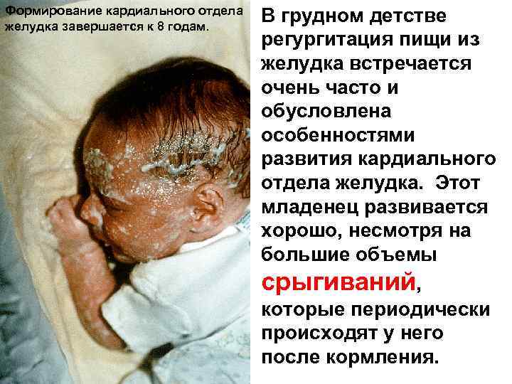 Формирование кардиального отдела желудка завершается к 8 годам. В грудном детстве регургитация пищи из