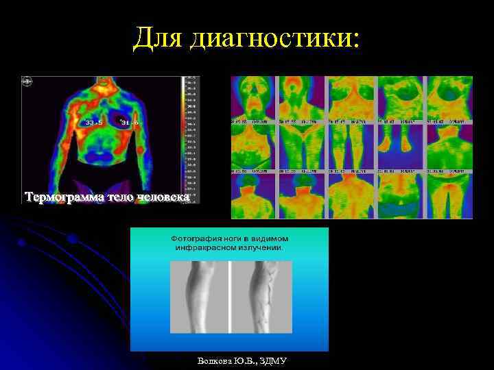 Для диагностики: Волкова Ю. В. , ЗДМУ 